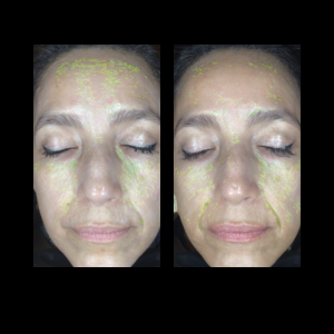 DIBI Milano Before and Afters