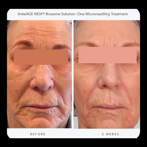 Exposomes Before and After