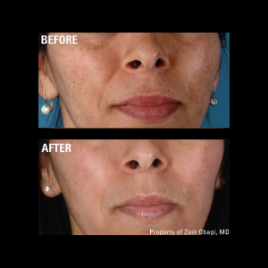 zo skin health Ageing before and after