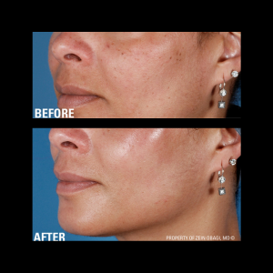 zo skin health Ageing before and after