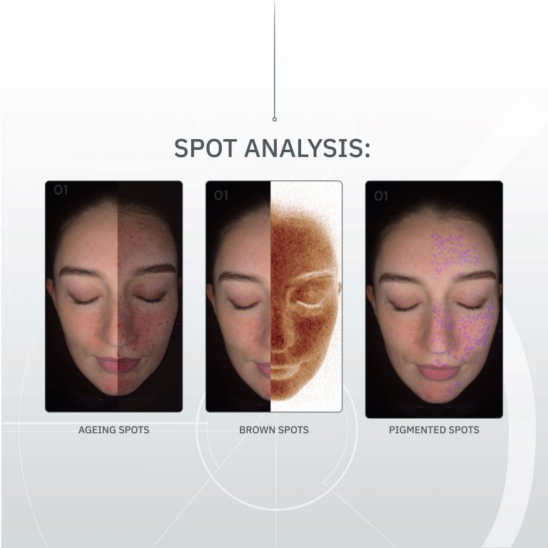 SKIN-ANALYSER-ASSETS5 2