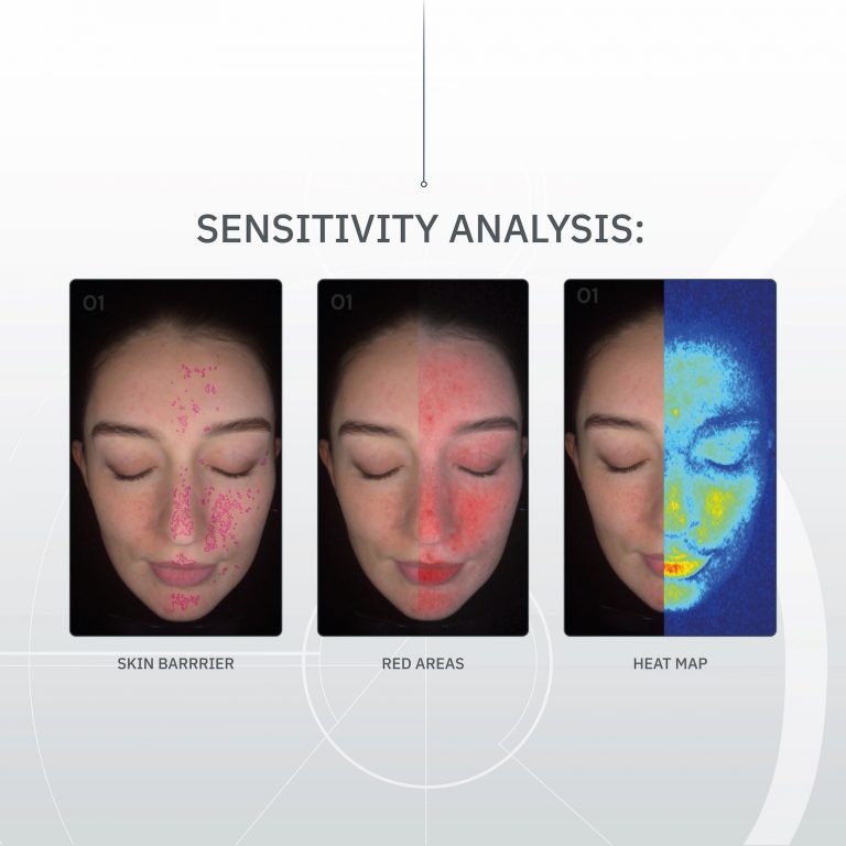 SKIN-ANALYSER-ASSETS6 3