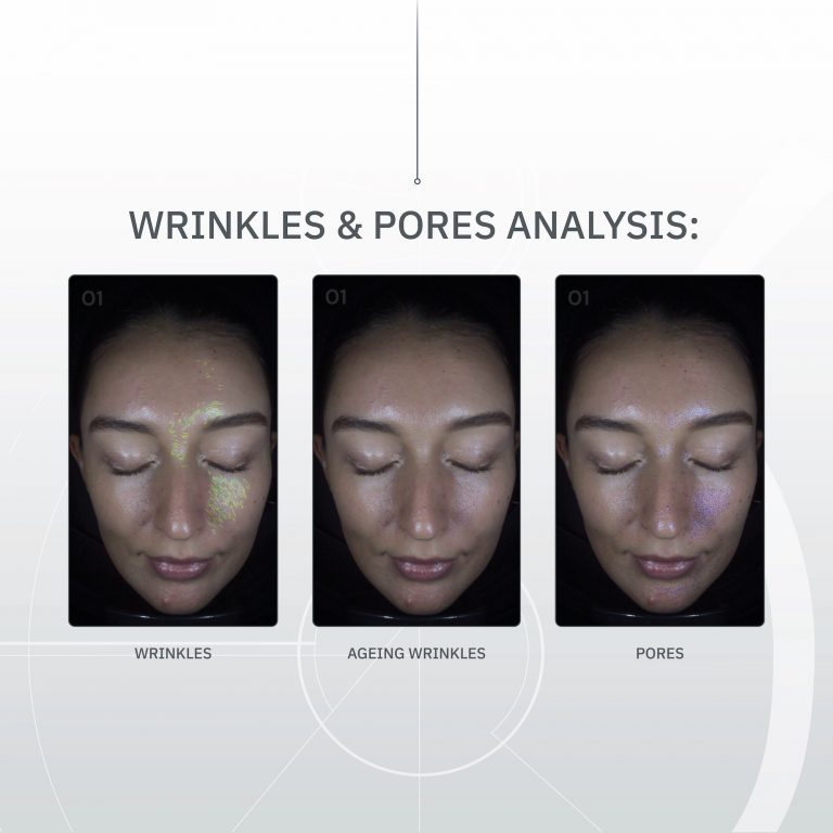 Skin Analyser